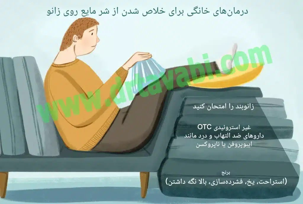 گرما یا یخ برای درد زانو؟ راهنمای انتخاب و استفاده ایمن - dr tavabi 621 2 افیوژن مفصلی، یا همان آب آوردن مفصل، به تجمع مایع اضافی داخل یا اطراف مفصل اشاره دارد. این وضعیت میتواند منجر به ظاهر پف کرده، تورم، درد و سفتی در زانو شود. برخلاف ادم عمومی، افیوژن مفصلی معمولاً ناشی از التهاب مفصل، آسیبهای ورزشی، بیماریهای التهابی یا عفونتهای مفصلی است. در این مقاله، شما با علل، علائم، تشخیص، درمان و پیشگیری از افیوژن مفصلی آشنا خواهید شد تا بتوانید در صورت بروز این مشکل، با اطلاعات کافی تصمیمگیری کنید.