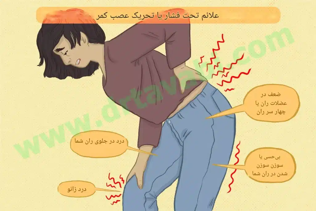 رابطه اختلالات کمر و درد زانو: آیا درد زانو می‌تواند از ستون فقرات ناشی شود؟