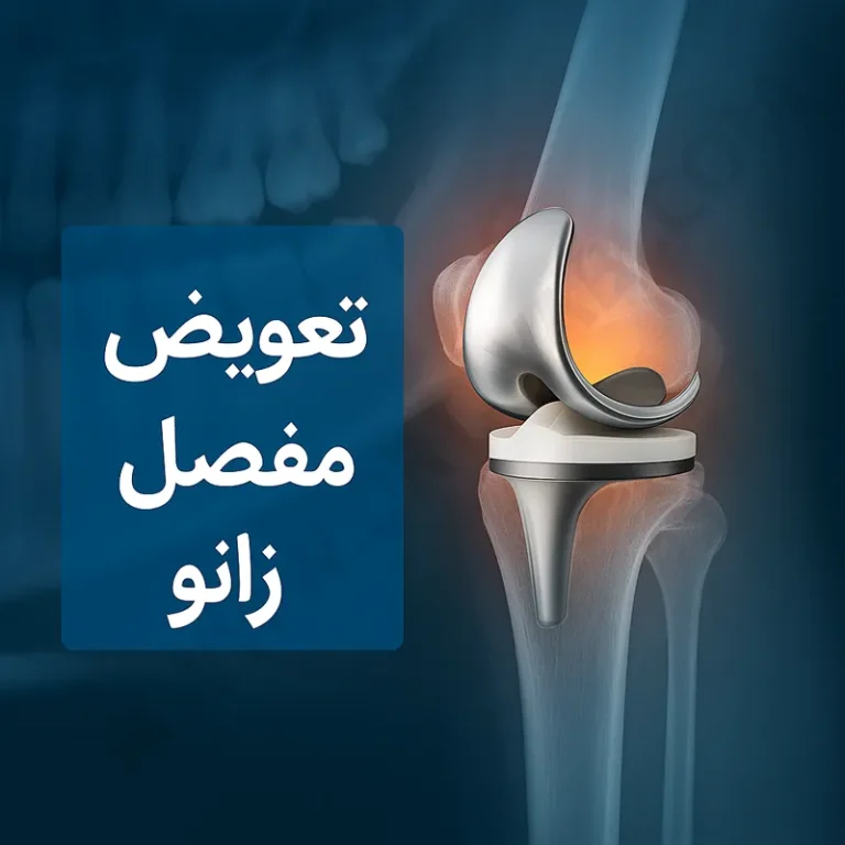 Comprehensive analysis: Unilateral versus simultaneous bilateral knee replacement