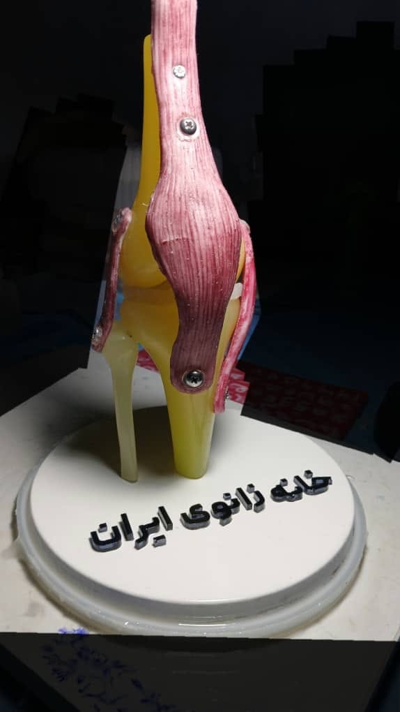 خانه زانو دکتر شایان توابی مرکز فوق تخصصی زانو و لگن