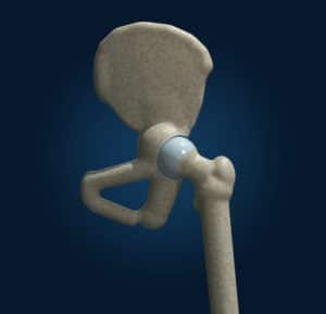 نقشه سایت خانه زانو دکتر شایان توابی - hip 3d poster