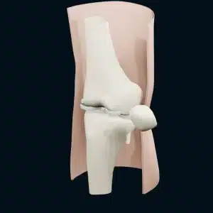 نقشه سایت خانه زانو دکتر شایان توابی - knee injury poster مدل سهبعدی آموزشی زانو با استخوان ران، درشتنی، منیسک و نمای برش پوست برای توضیح آسیب ورزشی