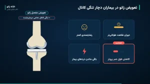 نقشه سایت خانه زانو دکتر شایان توابی - knee replacement spinal stenosis outcomes پیامدهای تعویض مفصل زانو در بیماران دچار تنگی کانال نخاعی درماننشده؛ رضایتمندی کمتر، نقاهت طولانیتر، درد باقیمانده و کاهش طول عمر پروتز